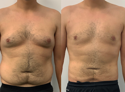 Liposuction Australia, Melbourne