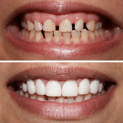 GlamSmile, Melbourne