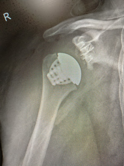 Mr Devinder Garewal - Orthopaedic Shoulder Surgeon - Melbourne Arm Clinic