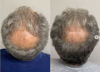 Bioscor International - Hair Regrowth & Hair Loss Clinic Melbourne | Cosmetic Medicine | Skin Treatments