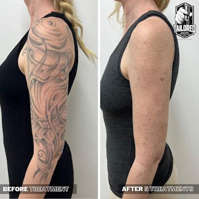 Tailored Tattoo Removal